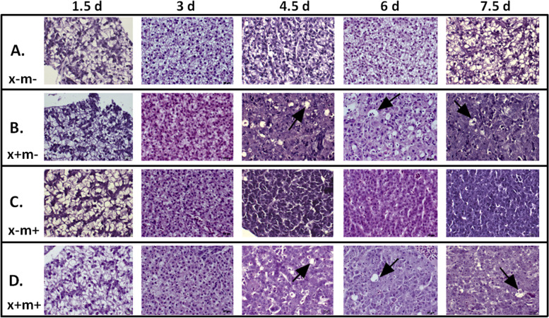 Identification of novel lipid biomarkers in xmrk- and Myc-induced models of hepatocellular carcinoma in zebrafish.