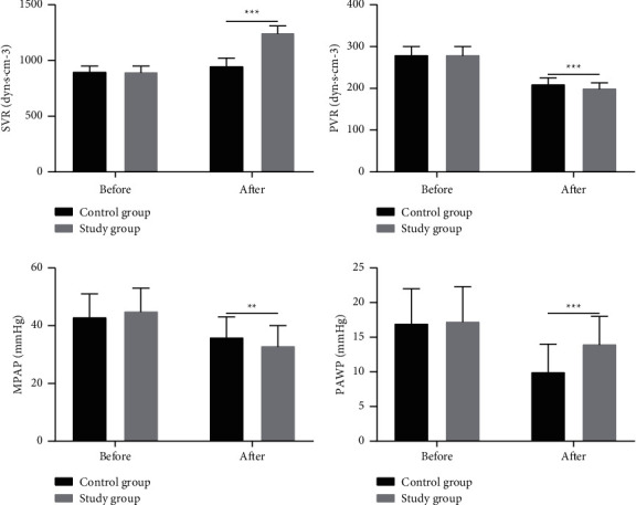 Clinical Efficacy of Budesonide/Glycopyrronium Bromide/Formoterol in the Treatment of Patients with Acute Respiratory Distress Syndrome and Its Effect on Inflammatory Factors.