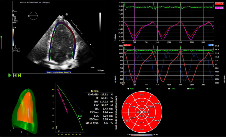 Difference in cardiac remodeling between female athletes and pregnant women: a case control study.