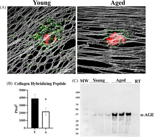 Another wrinkle with age: Aged collagen and intra-peritoneal metastasis of ovarian cancer