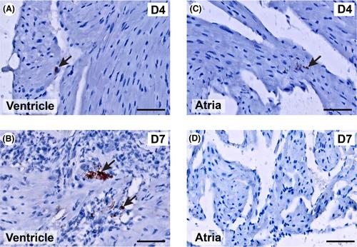 Transient atrial inflammation in a murine model of Coxsackievirus B3-induced myocarditis