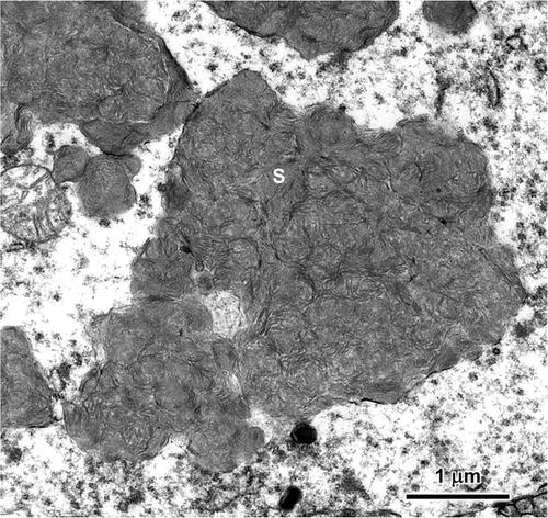 Characterization of neurological disease progression in a canine model of CLN5 neuronal ceroid lipofuscinosis