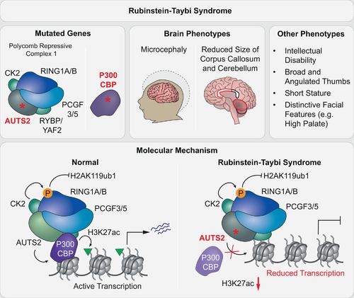 Polycomb-mediated gene regulation in human brain development and neurodevelopmental disorders