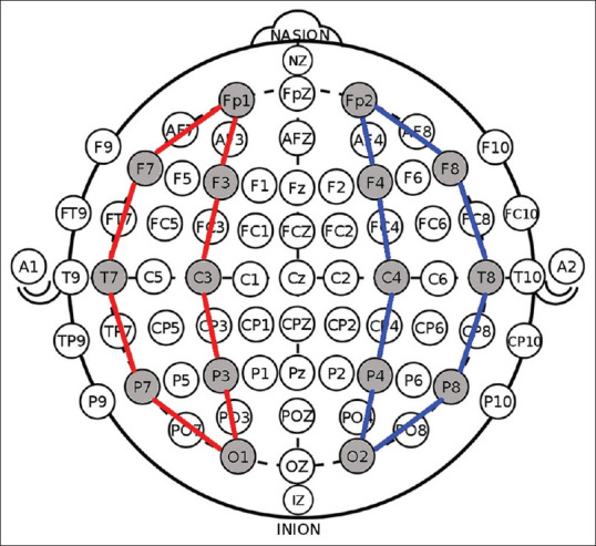 Quantitative Analysis of Inter- and Intrahemispheric Coherence on Epileptic Electroencephalography Signal.