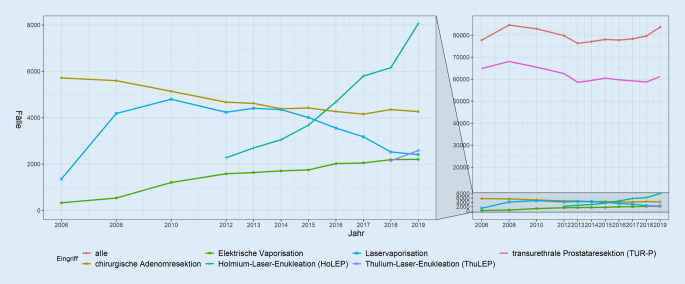 [Contemporary surgical management of benign prostatic obstruction in Germany : A population-wide study based on German hospital quality report data from 2006 to 2019].