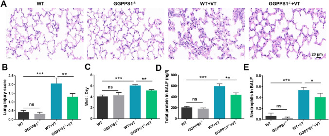 Knockout of GGPPS1 restrains rab37-mediated autophagy in response to ventilator-induced lung injury.