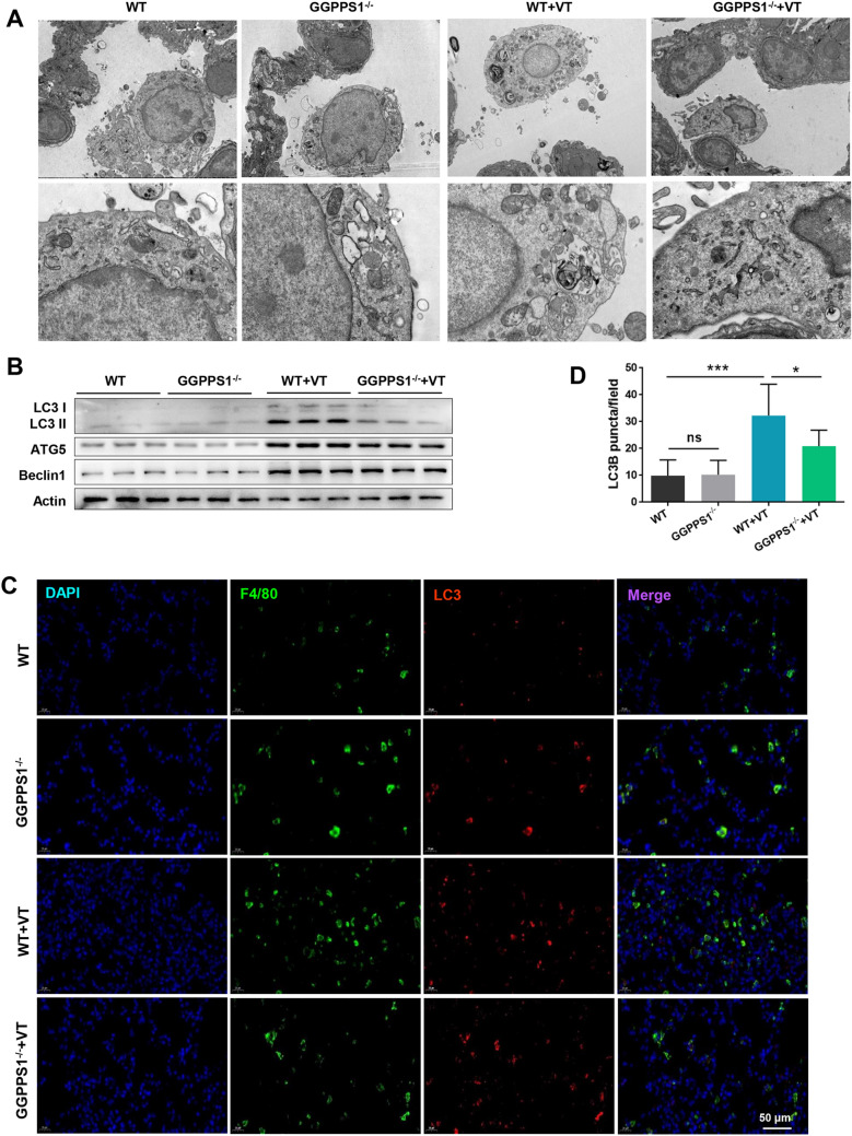 Knockout of GGPPS1 restrains rab37-mediated autophagy in response to ventilator-induced lung injury.