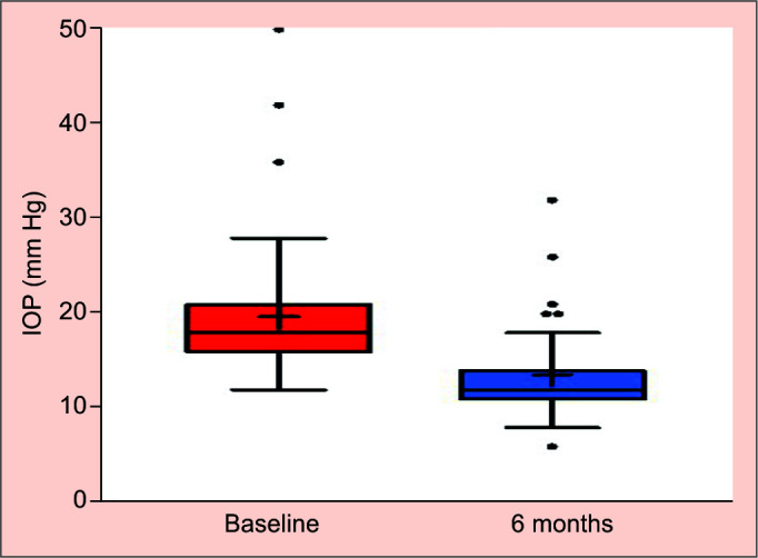 Efficacy of the XEN45 Implant in Advanced to End-stage Glaucoma Patients.