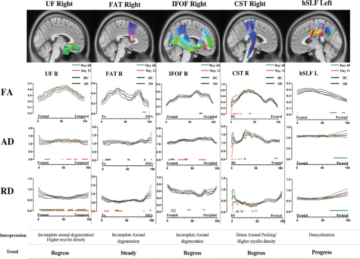 Can diffusion tensor imaging (DTI) outperform standard magnetic resonance imaging (MRI) investigations in post-COVID-19 autoimmune encephalitis?