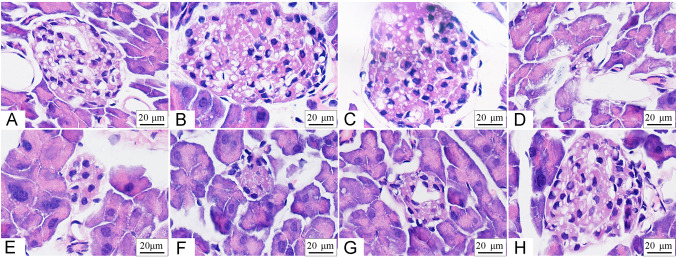 Hypolipidemic effect of chromium-modified enzymatic product of sulfated rhamnose polysaccharide from <i>Enteromorpha prolifera</i> in type 2 diabetic mice.