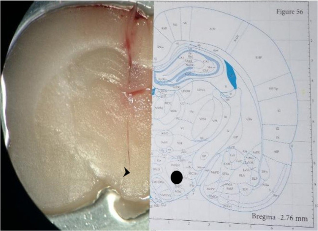 Lateral Hypothalamus Corticotropin-releasing Hormone Receptor-1 Inhibition and Modulating Stress-induced Anxiety Behavior.