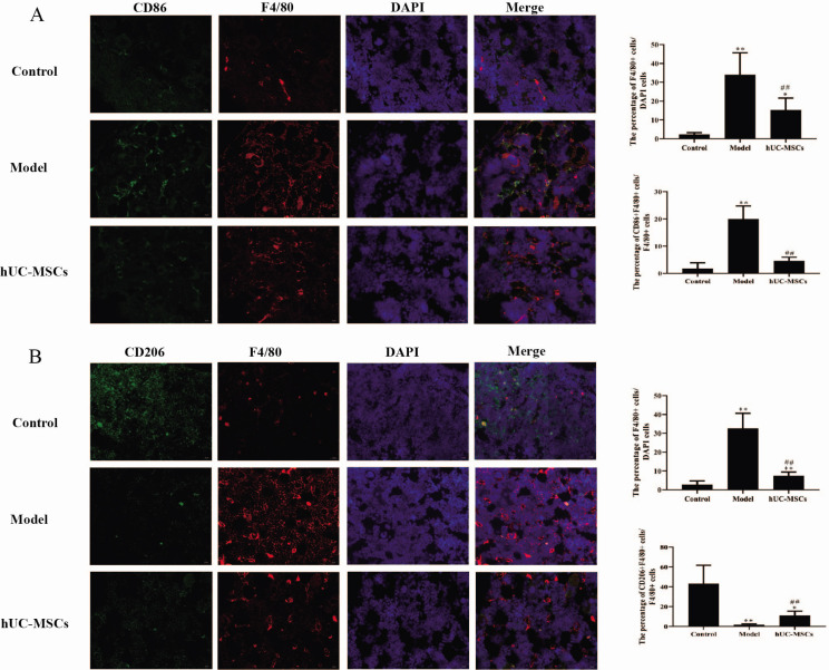 Human Umbilical Cord Mesenchymal Stem Cells Improve the Necrosis and Osteocyte Apoptosis in Glucocorticoid-Induced Osteonecrosis of the Femoral Head Model through Reducing the Macrophage Polarization.