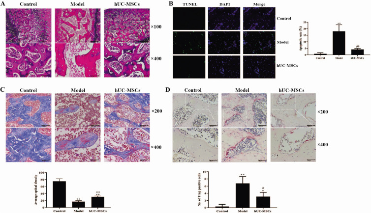 Human Umbilical Cord Mesenchymal Stem Cells Improve the Necrosis and Osteocyte Apoptosis in Glucocorticoid-Induced Osteonecrosis of the Femoral Head Model through Reducing the Macrophage Polarization.