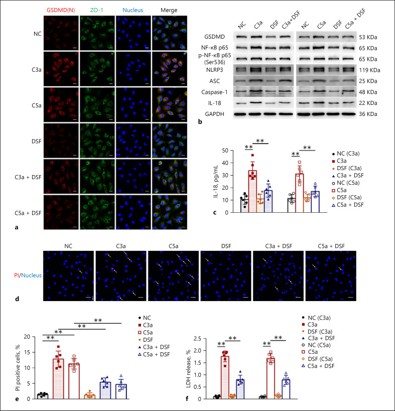Treatment of Membranous Nephropathy by Disulfiram through Inhibition of Podocyte Pyroptosis.