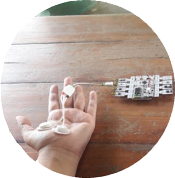 Electrodermal Activity for Measuring Cognitive and Emotional Stress Level.