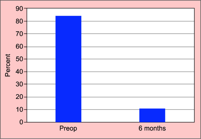 Efficacy and Safety of iStent Inject Implantation in Manual and Femtosecond Laser-assisted Cataract Surgery before Lens Extraction.