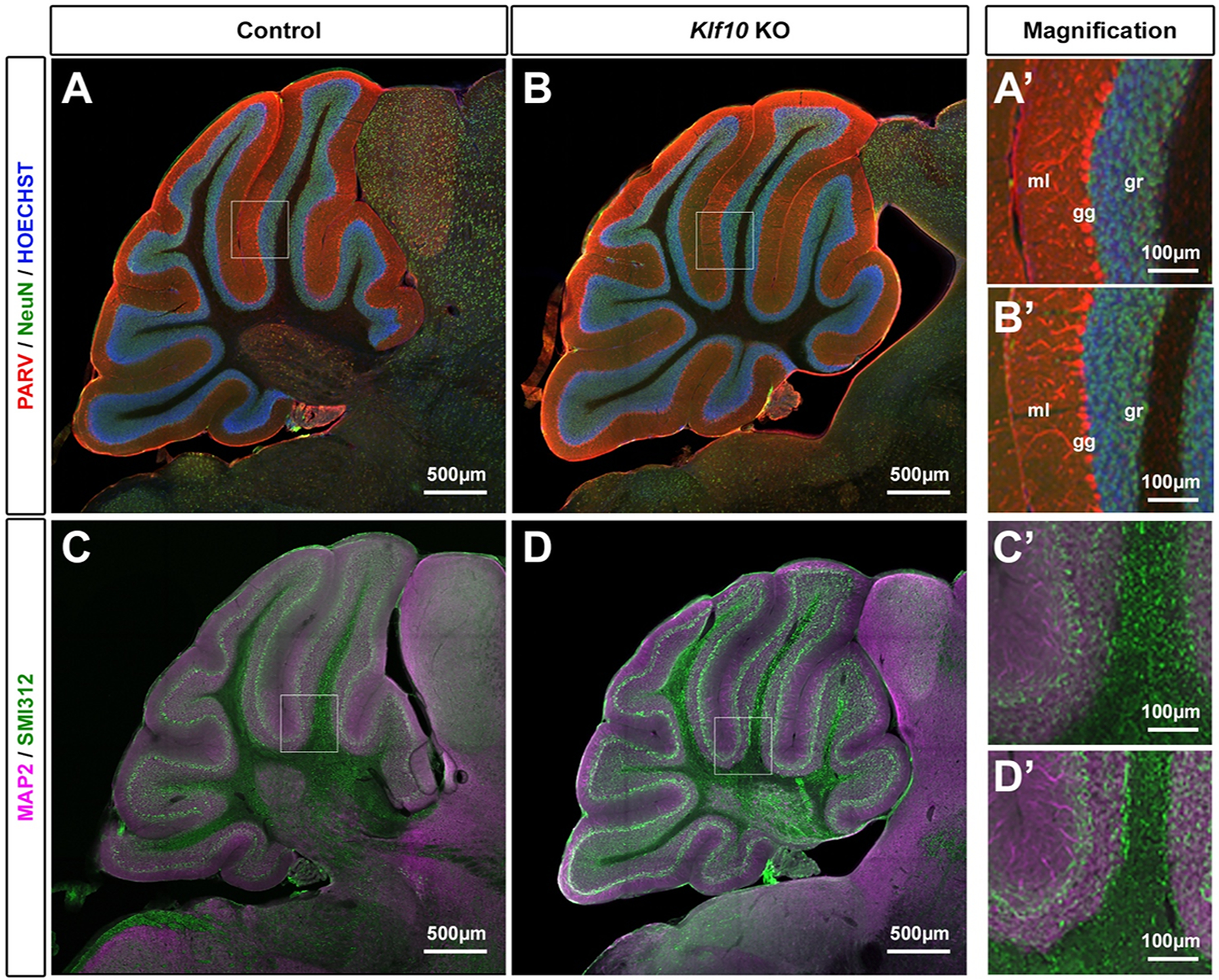 Deciphering the Role of <i>Klf10</i> in the Cerebellum.