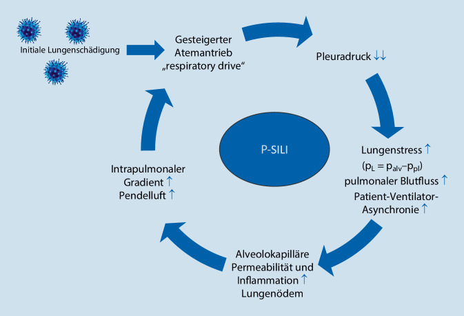 [Noninvasive respiratory support and invasive ventilation in COVID‑19 : Where do we stand today?]