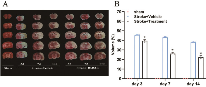 Effects and Mechanisms of Bone Marrow Mesenchymal Stem Cell Transplantation for Treatment of Ischemic Stroke in Hypertensive Rats.