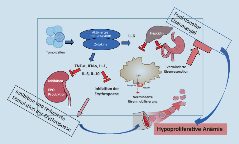 [G-CSF for prophylaxis of neutropenia and febrile neutropenia, anemia in cancer : Guidelines on supportive treatment part 1].