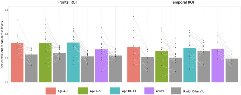 A Weak Shadow of Early Life Language Processing Persists in the Right Hemisphere of the Mature Brain.