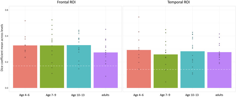 A Weak Shadow of Early Life Language Processing Persists in the Right Hemisphere of the Mature Brain.