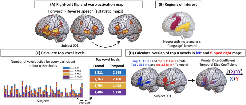 A Weak Shadow of Early Life Language Processing Persists in the Right Hemisphere of the Mature Brain.