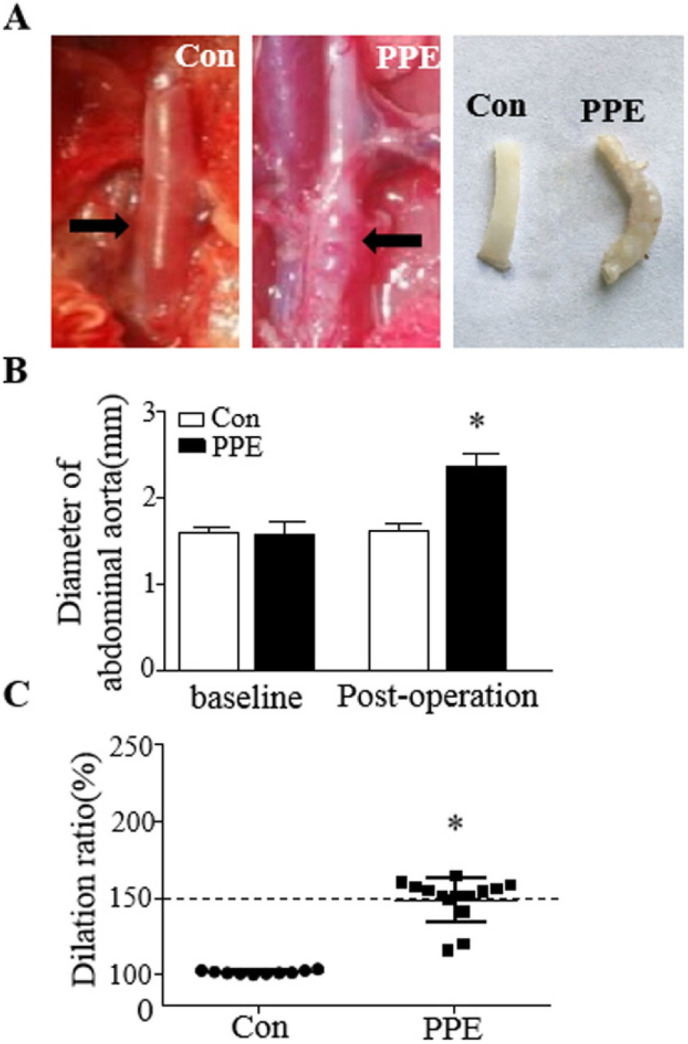 Evaluation of Circulating Endothelial Progenitor Cells in Abdominal Aortic Aneurysms after Endovascular Aneurysm Repair.