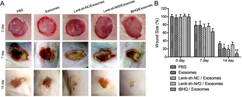 Pharmaceutical Activation of Nrf2 Accelerates Diabetic Wound Healing by Exosomes from Bone Marrow Mesenchymal Stem Cells.