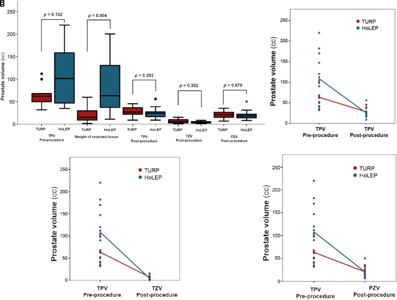 Morphometric Analysis of Prostate Zonal Anatomy After Transurethral Resection of Prostate and Holmium Laser Enucleation of Prostate Using Magnetic Resonance Imaging: A Pilot Study.