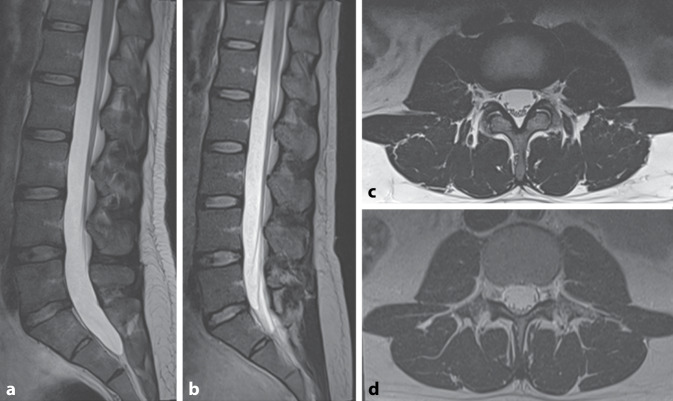 [New clinical applications for low-field magnetic resonance imaging : Technical and physical aspects].