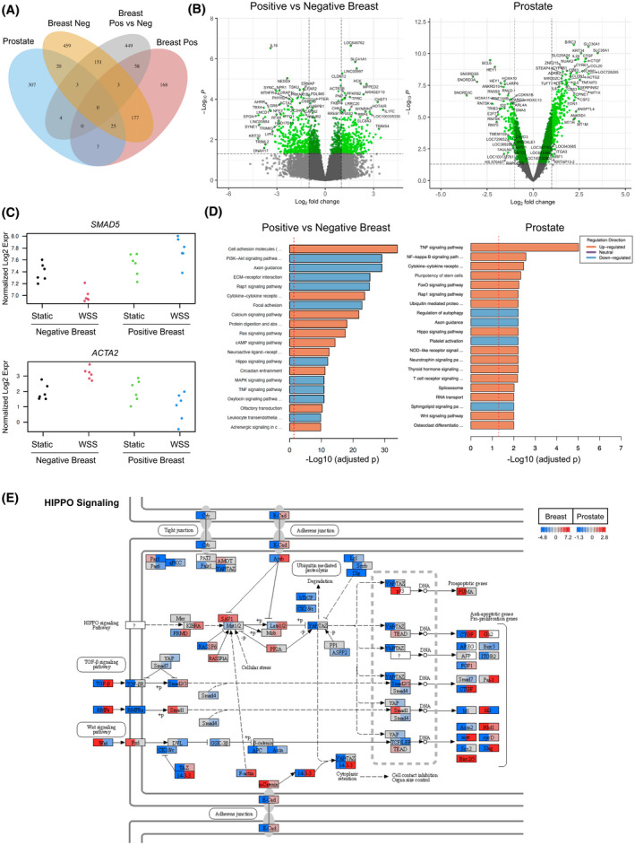 RhoA-ROCK competes with YAP to regulate amoeboid breast cancer cell migration in response to lymphatic-like flow.