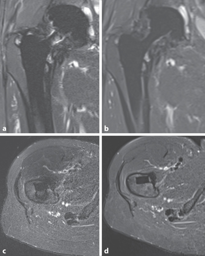 [New clinical applications for low-field magnetic resonance imaging : Technical and physical aspects].