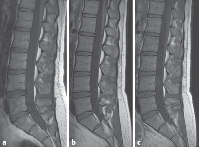 [New clinical applications for low-field magnetic resonance imaging : Technical and physical aspects].