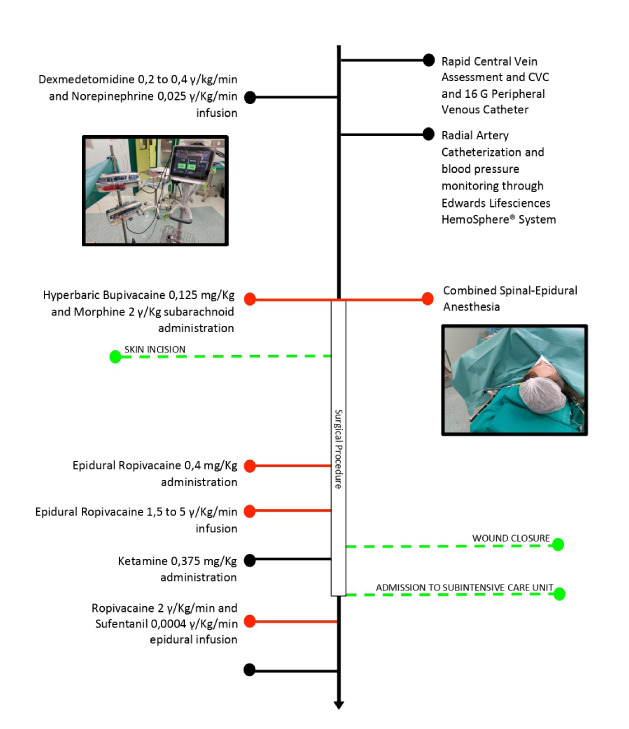 Combined spinal-epidural anesthesia for renal transplant in a lung transplant recipient: a case report.