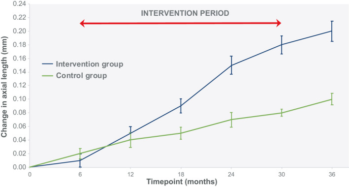 The effect of peripheral defocus on axial growth and modulation of refractive error in hyperopes.