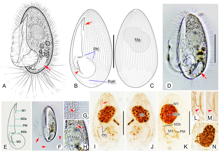 Integrative studies on the taxonomy and molecular phylogeny of four new <i>Pleuronema</i> species (Protozoa, Ciliophora, Scuticociliatia).