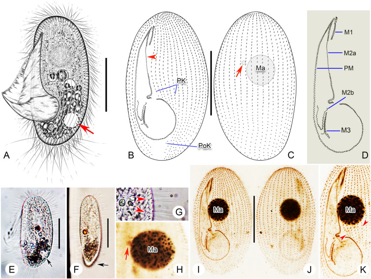 Integrative studies on the taxonomy and molecular phylogeny of four new <i>Pleuronema</i> species (Protozoa, Ciliophora, Scuticociliatia).