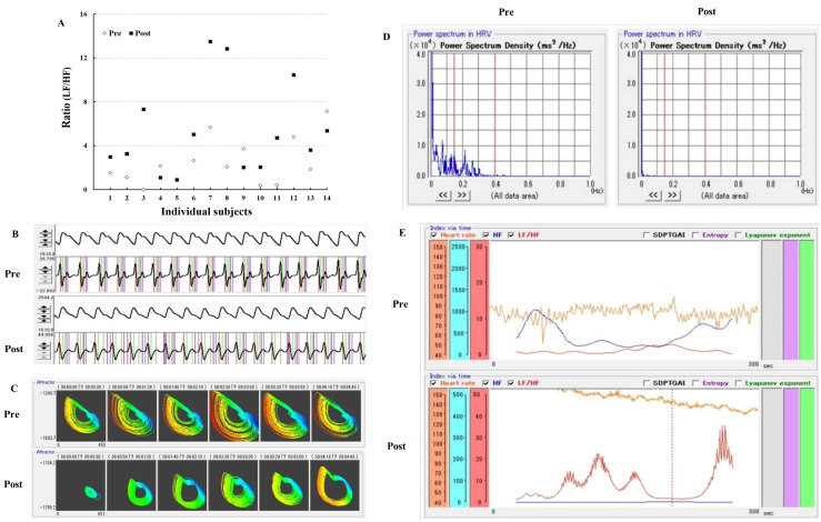 Changes in Keyboard Typing Accuracy and Spatial Perception after Cardiovascular Fitness Exercise.