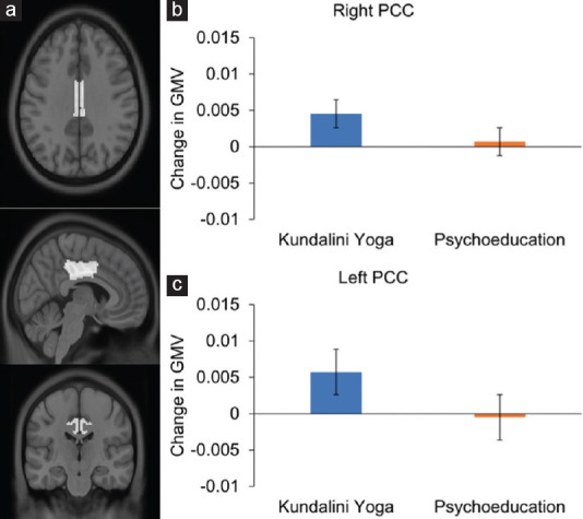 Kundalini Yoga Intervention Increases Hippocampal Volume in Older Adults: A Pilot Randomized Controlled Trial.