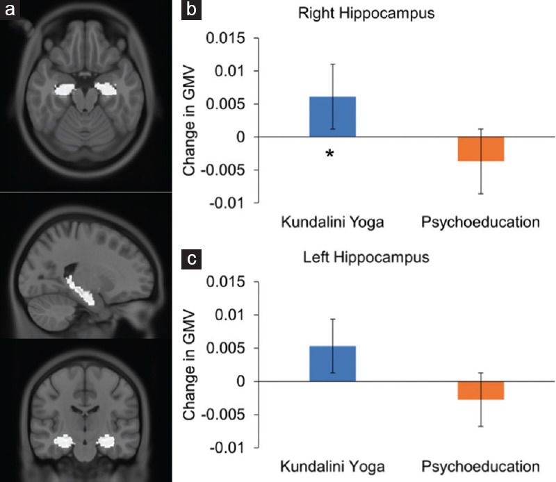 Kundalini Yoga Intervention Increases Hippocampal Volume in Older Adults: A Pilot Randomized Controlled Trial.