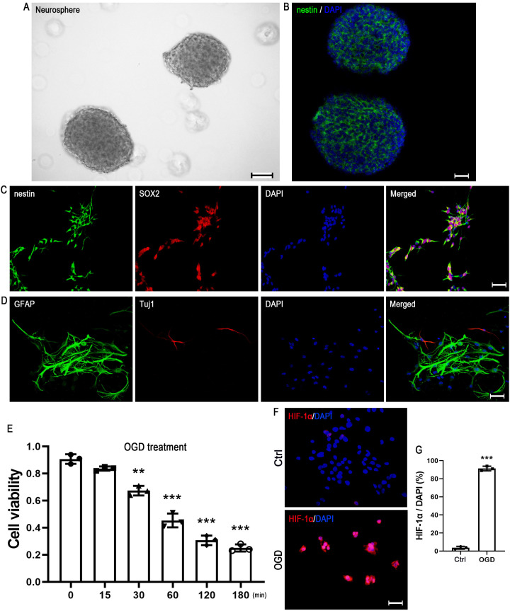 BMP-6 Attenuates Oxygen and Glucose Deprivation-Induced Apoptosis in Human Neural Stem Cells through Inhibiting p38 MAPK Signaling Pathway.