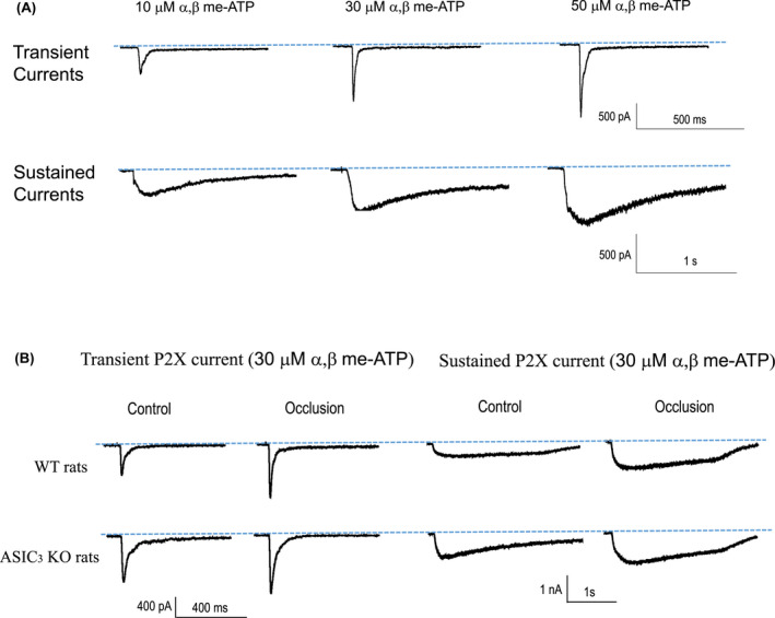 ASIC3 knockout alters expression and activity of P2X3 in muscle afferent nerves of rat model of peripheral artery disease.