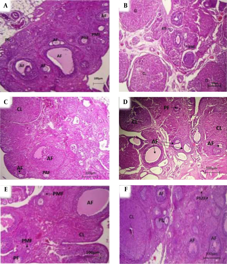 Maternal Exposure to D-galactose Reduces Ovarian Reserve in Female Rat Offspring Later in Life.