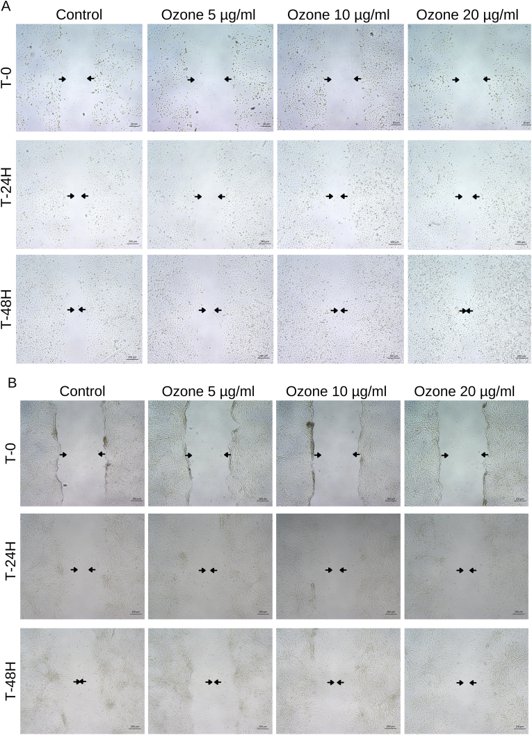 The apoptotic effect of ozone therapy on mitochondrial activity of highly metastatic breast cancer cell line MDA-MB-231 using in vitro approaches