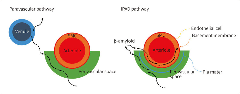 [An Enlarged Perivascular Space: Clinical Relevance and the Role of Imaging in Aging and Neurologic Disorders].