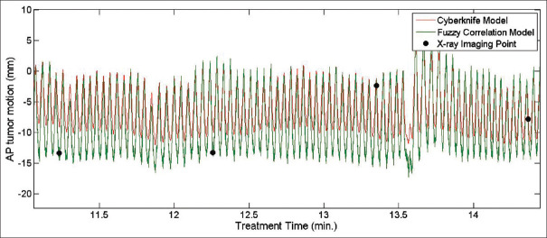 Investigation the Efficacy of Fuzzy Logic Implementation at Image-Guided Radiotherapy.