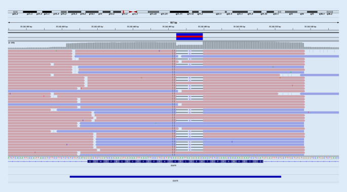 [Molecule pathology in the treatment of lung cancer-Interdisciplinary view of the importance in thoracic surgery].