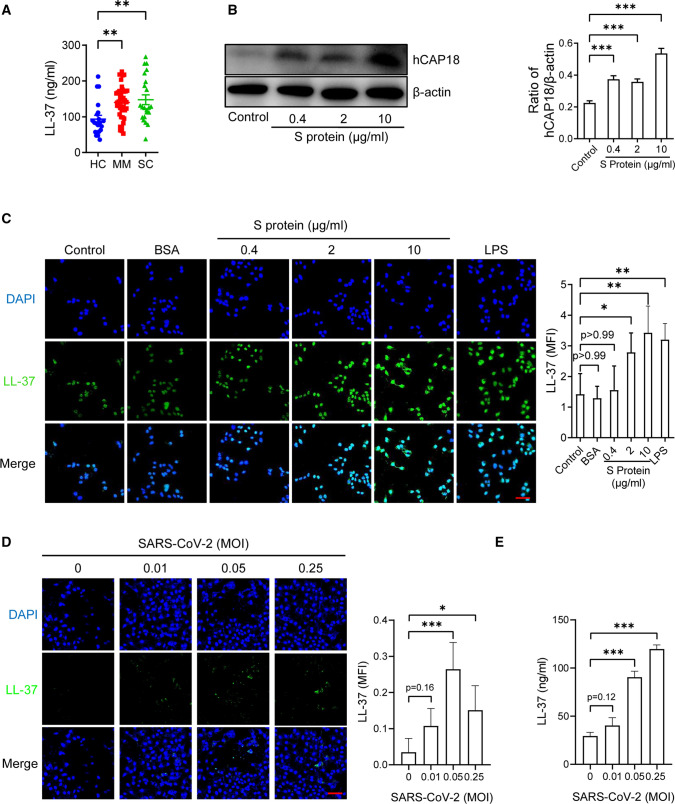 Role of LL-37 in thrombotic complications in patients with COVID-19.