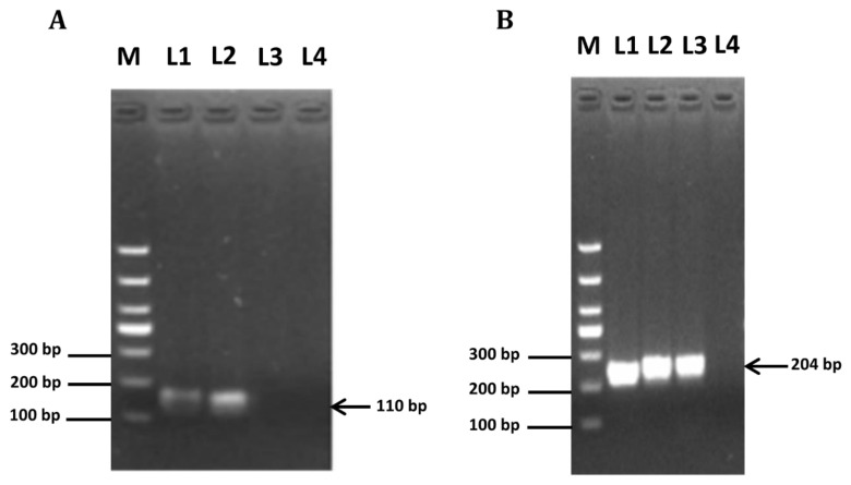 Anti-Müllerian Hormone Inhibits FSH-Induced Cumulus Oocyte Complex In Vitro Maturation and Cumulus Expansion in Mice.